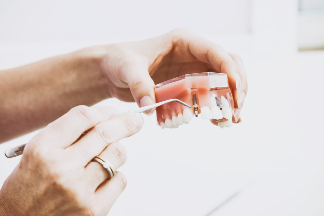 hands holding and demonstrating a dental implant model